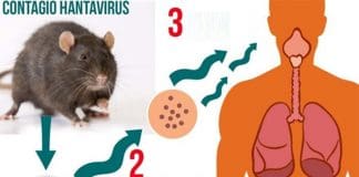 Cause Of Hantavirus