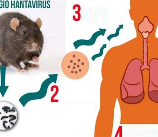 Cause Of Hantavirus