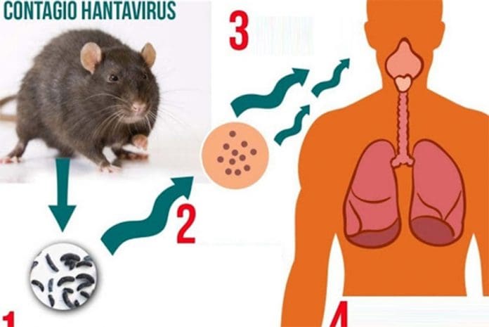 Cause Of Hantavirus