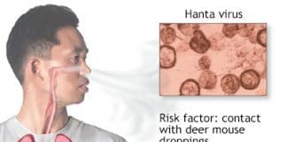 Hantavirus